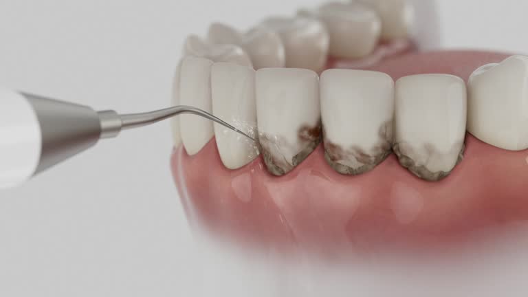 Reliable Dental Implants contractor in Gresham Park, GA by Smile Center Dentistry